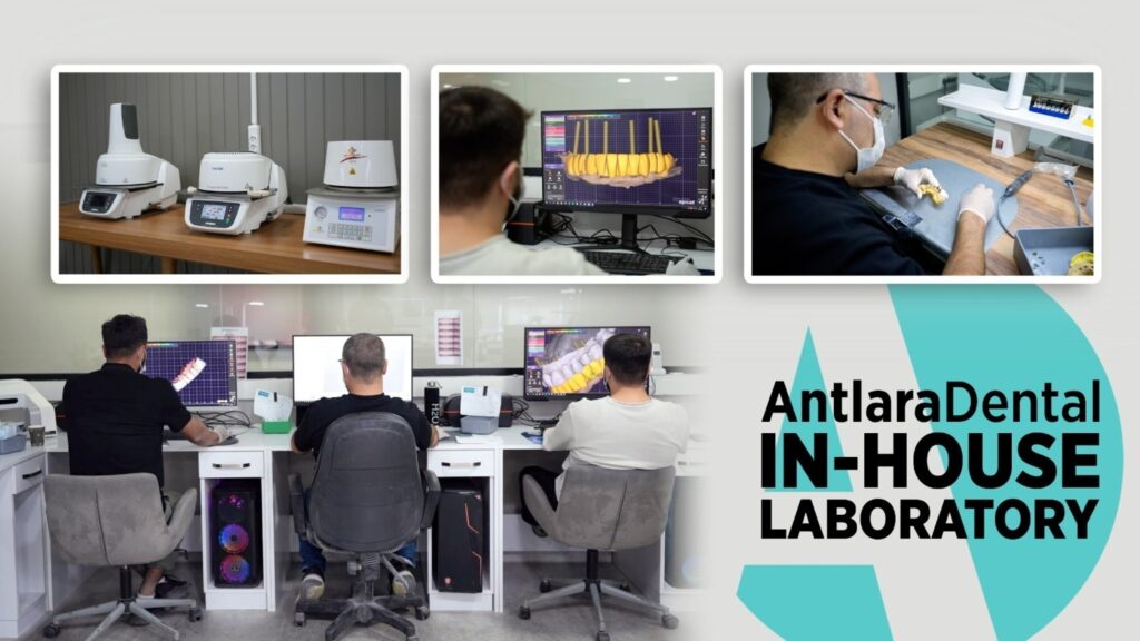 antlara dental introduces its in house laboratory